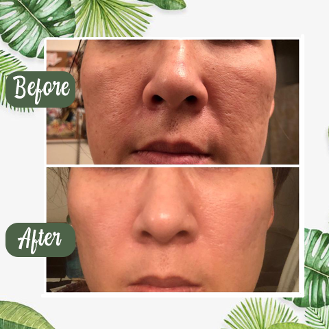 Diystar™  100% Natural Green Tea Deep Cleanse Mask