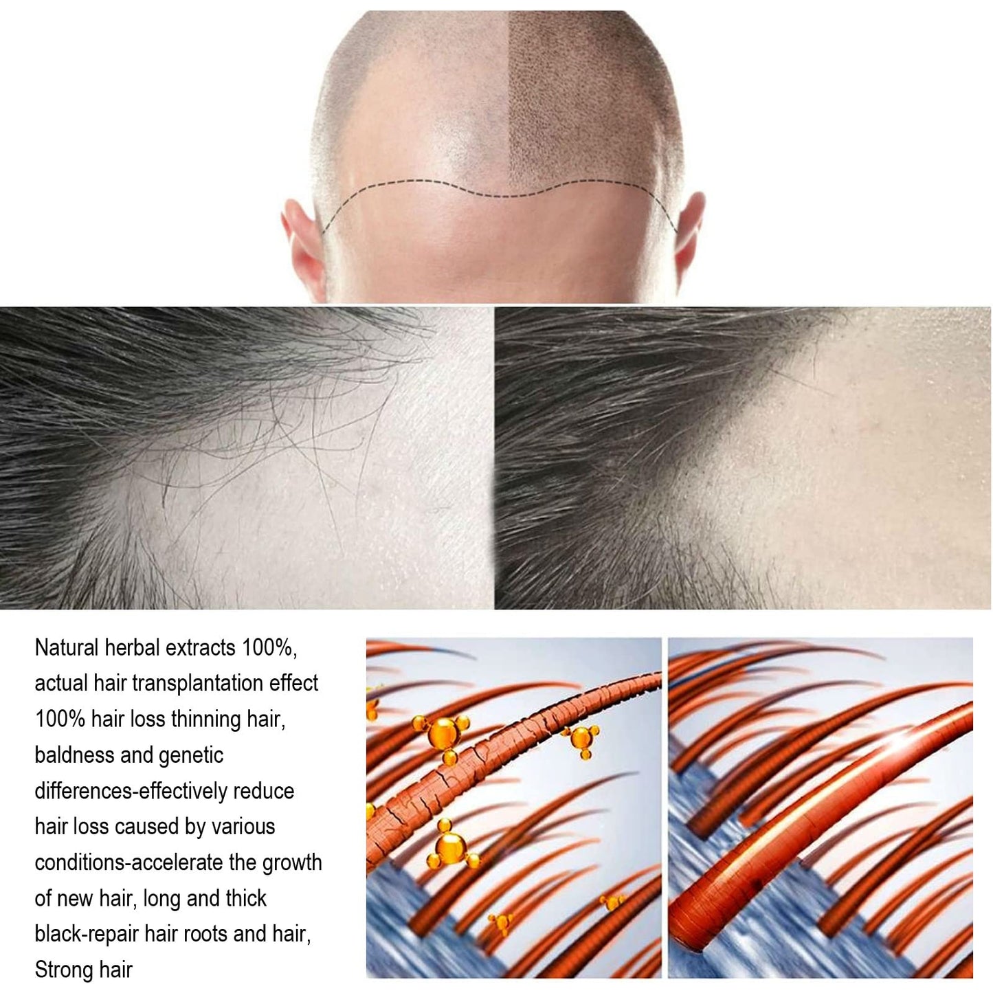 HZA- Root Infusion Kit 🌱