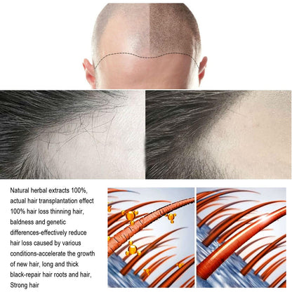 HZA- Root Infusion Kit 🌱