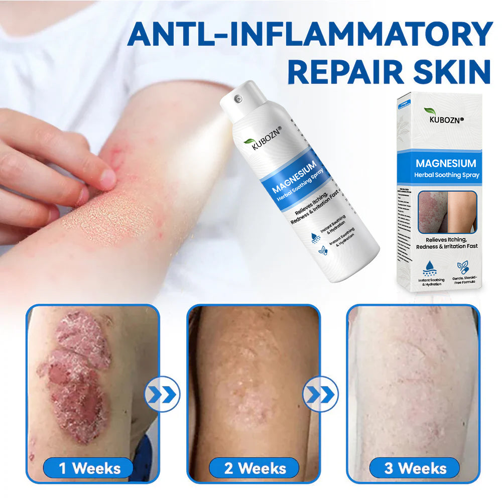 ✅  Official Store: KUBOZN® Magnesium Herbal Psoriasis Spray ⚕️