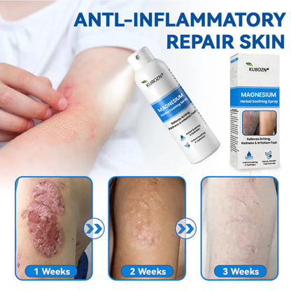 ✅  Official Store: KUBOZN® Magnesium Herbal Psoriasis Spray ⚕️