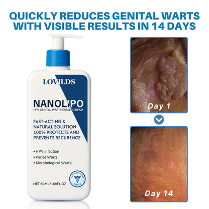 LOVILDS® NanoLipo HPV Genital Warts Eraser Cream