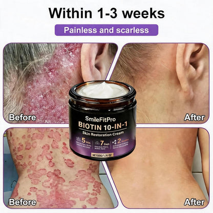 Made and Shipped from USA ✨SmileFitPro™ Biotin 10-in-1 Skin Restoration Cream 🍀