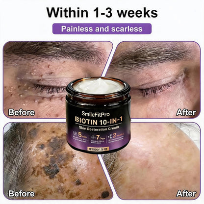 Made and Shipped from USA ✨SmileFitPro™ Biotin 10-in-1 Skin Restoration Cream 🍀