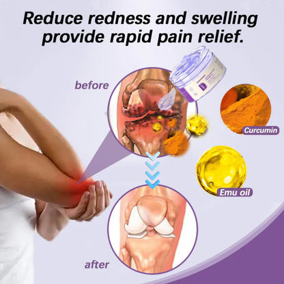 ✅ Official store: Velmoriona™ Turmeric & Emu Oil Arthritis Soothing Pain Relief Massage Gel(👨‍⚕️AAD Recommended)