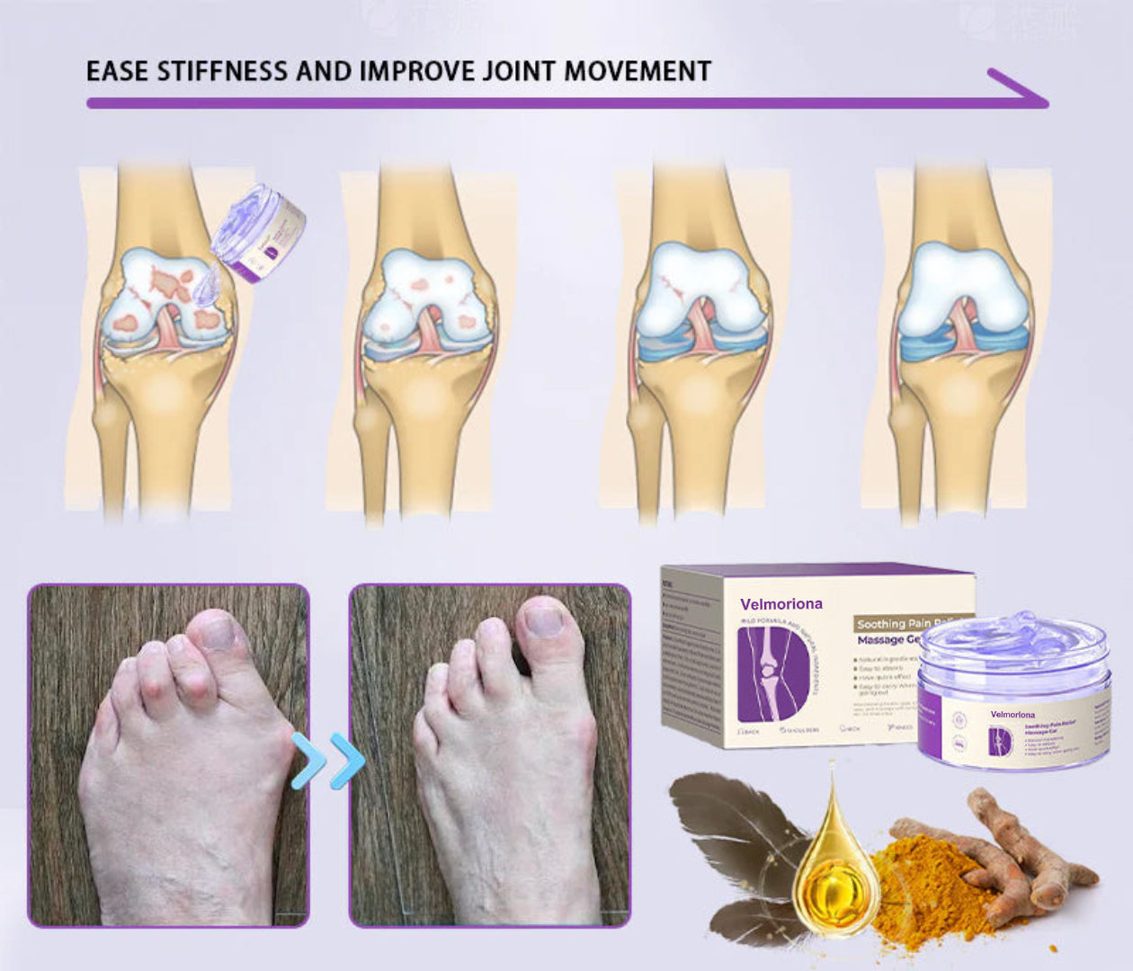 ✅ Official store: Velmoriona™ Turmeric & Emu Oil Arthritis Soothing Pain Relief Massage Gel(👨‍⚕️AAD Recommended)