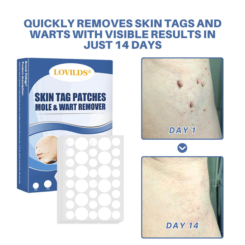 LOVILDS® Moles & Warts Removing Skin Tag Patch