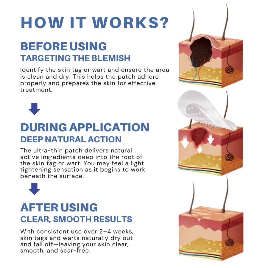 LOVILDS® Moles & Warts Removing Skin Tag Patch