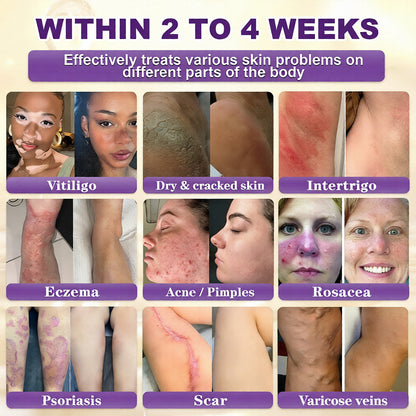 Made and Shipped from USA ✨SmileFitPro™ Biotin 10-in-1 Skin Restoration Cream 🍀