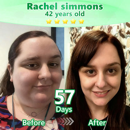 𝐔𝐒𝐀 𝐃𝐨𝐜𝐭𝐨𝐫 𝐑𝐞𝐜𝐨𝐦𝐦𝐞𝐧𝐝𝐞𝐝🌟| SmileFitPro® 𝑩𝒆𝒓𝑏𝘦𝘳𝑖𝗇𝒆 𝟔-𝗶𝙣-𝟏 𝑁𝑎𝑛𝑜 𝘔𝘪𝘤𝘳𝘰𝘯𝘦𝘦𝘥𝘭𝘦 𝖯𝚊𝗍𝖼𝗁 |✅𝘉𝘢𝘤𝘬𝘦𝘥 𝘣𝘺 𝘴𝘤𝘪𝘦𝘯𝘤𝘦 | 𝟨-𝗂𝗇-𝟣 𝖿𝗈𝗋𝗆𝗎𝗅𝖺 | 𝑅𝑒𝑠𝑢𝑙𝑡𝑠 𝑖𝑛 7 𝑑𝑎𝑦𝑠 🏅