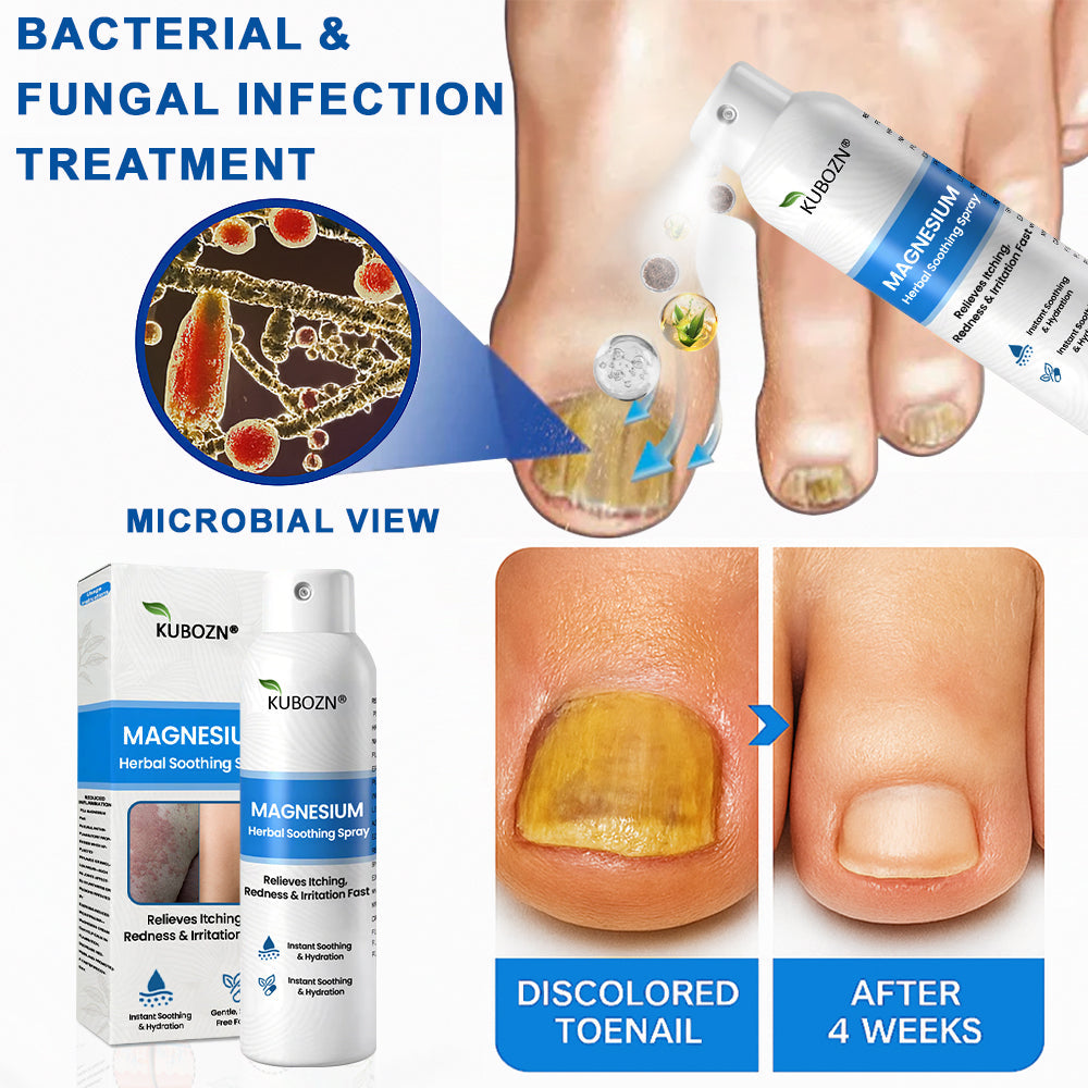 ✅  Official Store: KUBOZN® Magnesium Herbal Psoriasis Spray ⚕️