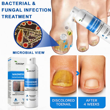 ✅  Official Store: KUBOZN® Magnesium Herbal Psoriasis Spray ⚕️