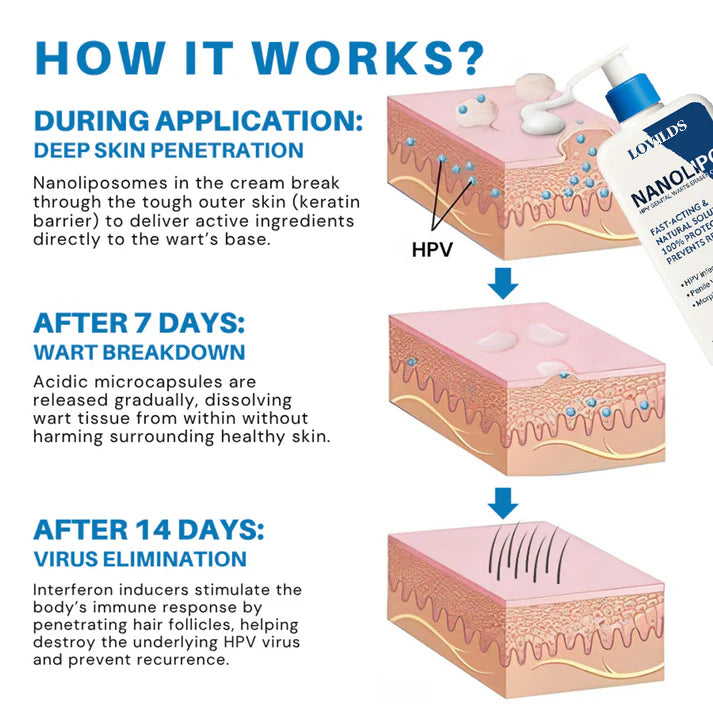 LOVILDS® NanoLipo HPV Genital Warts Eraser Cream