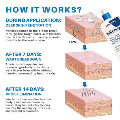 LOVILDS® NanoLipo HPV Genital Warts Eraser Cream