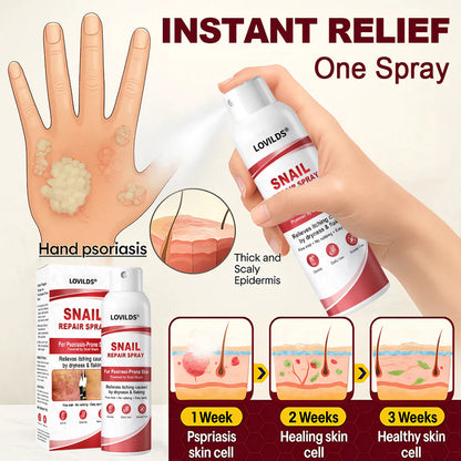 LOVILDS® Snail Repair Spray for Itchy, Flaky Psoriasis Skin