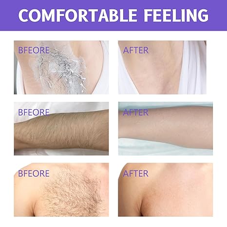 Gentle Hair Removal Cream✨Finally, Smooth Skin Without Razors, Waxing or Pain ✨