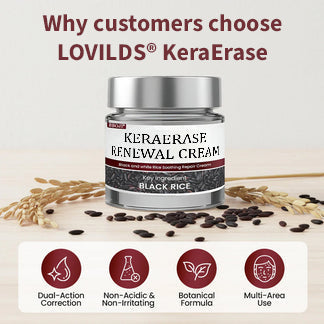✅Flash Sale - LOVILDS®KeraErase Dual-Action Renewal Cream