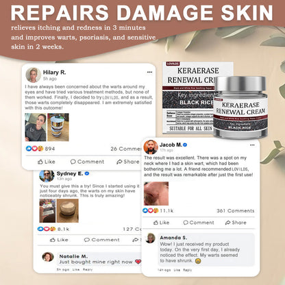 ✅Flash Sale - LOVILDS®KeraErase Dual-Action Renewal Cream