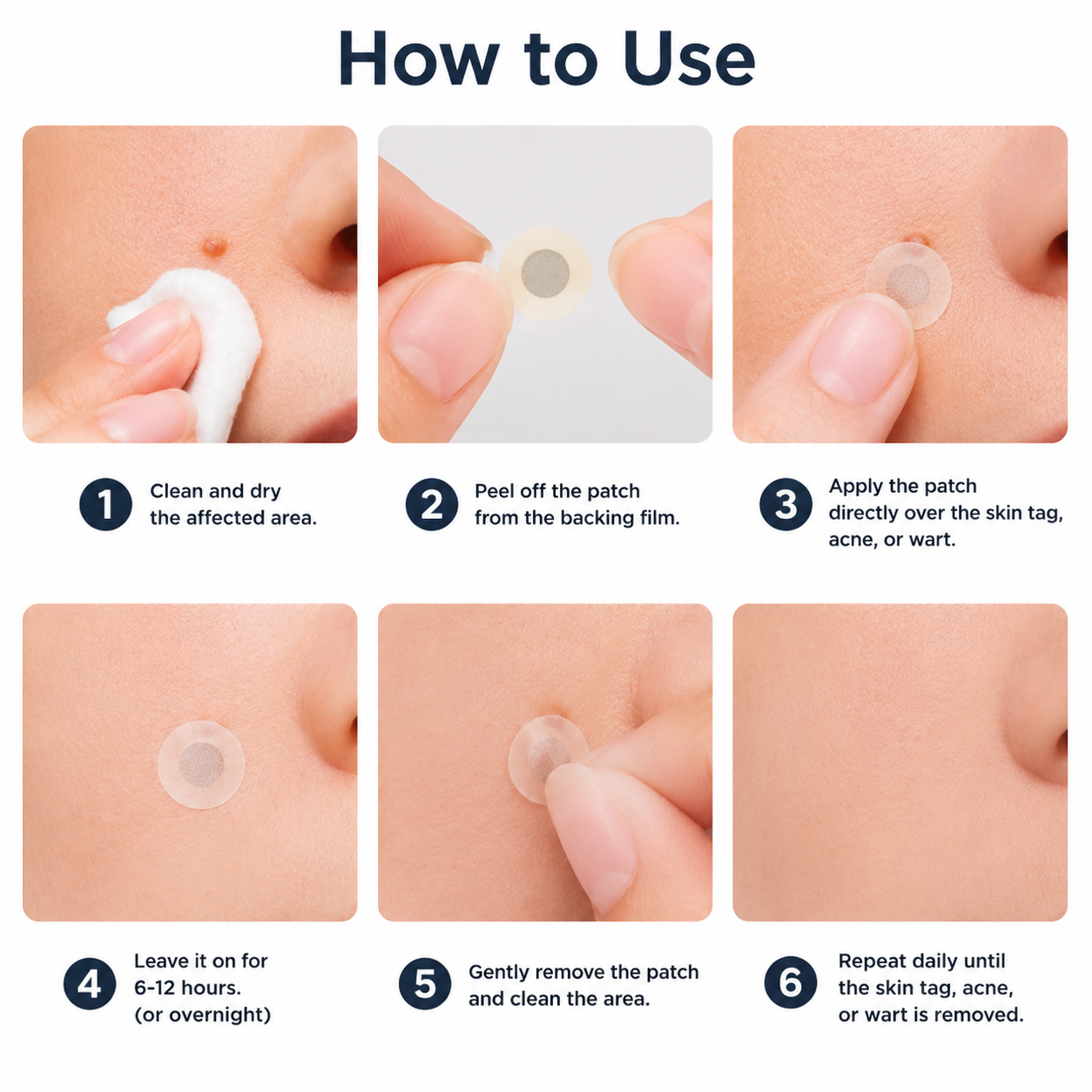 ✨ COUGEX Acne & Wart Care Patches – 2-in-1 Microneedle + Hydrocolloid Targeted Care 🌿