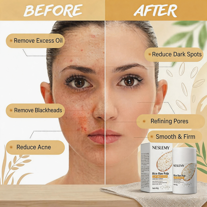 🌾 RicePure Clay Mask Stick – Deep Pore Cleansing & Oil Control for Smooth-Looking Skin