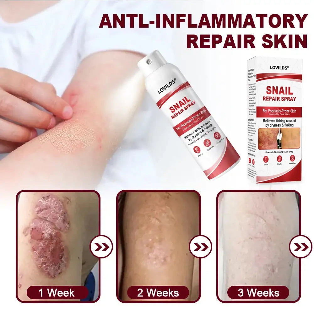 LOVILDS® Snail Repair Spray for Itchy, Flaky Psoriasis Skin